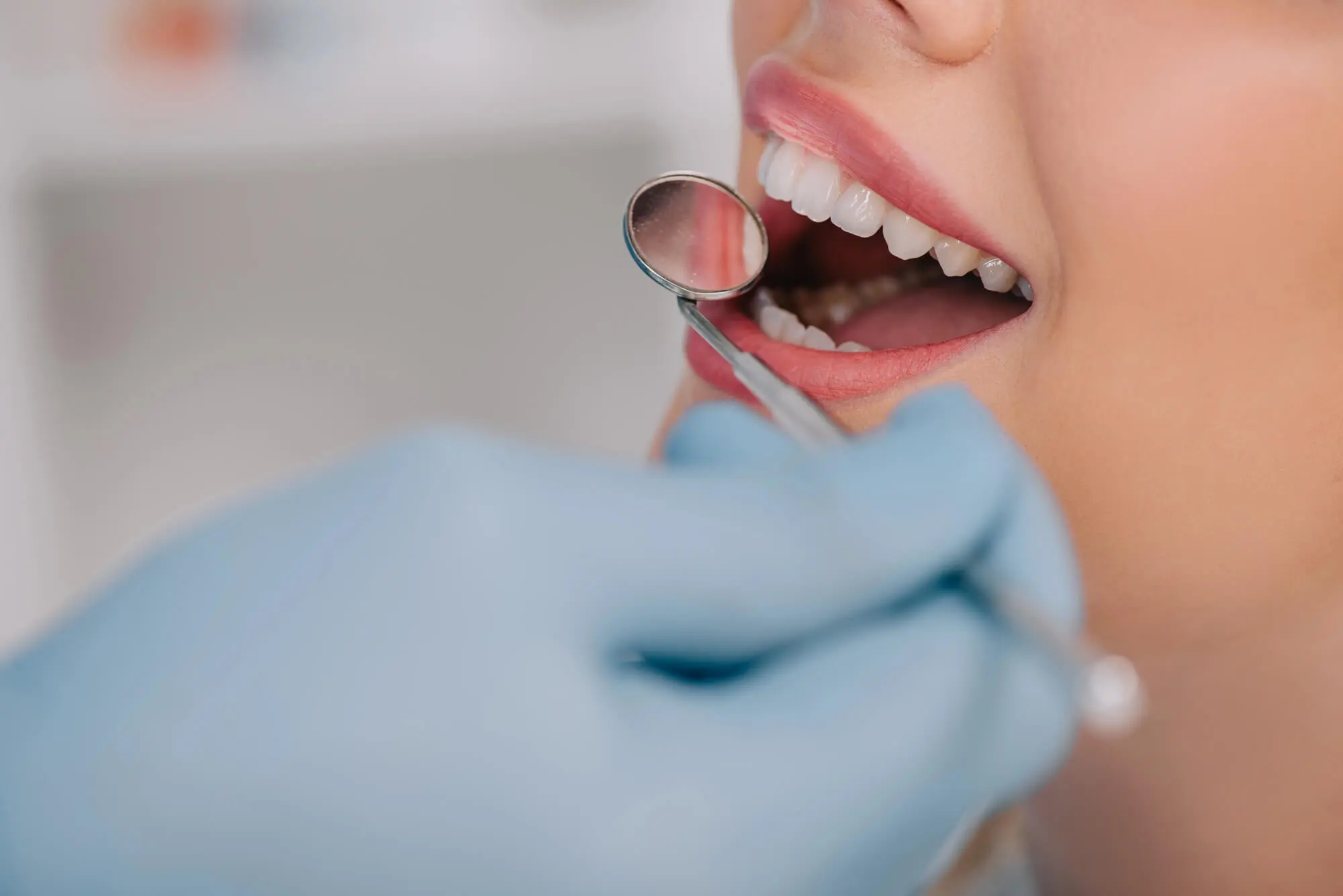 Close-up dental checkup with mirror Dentist in North Charleston SC