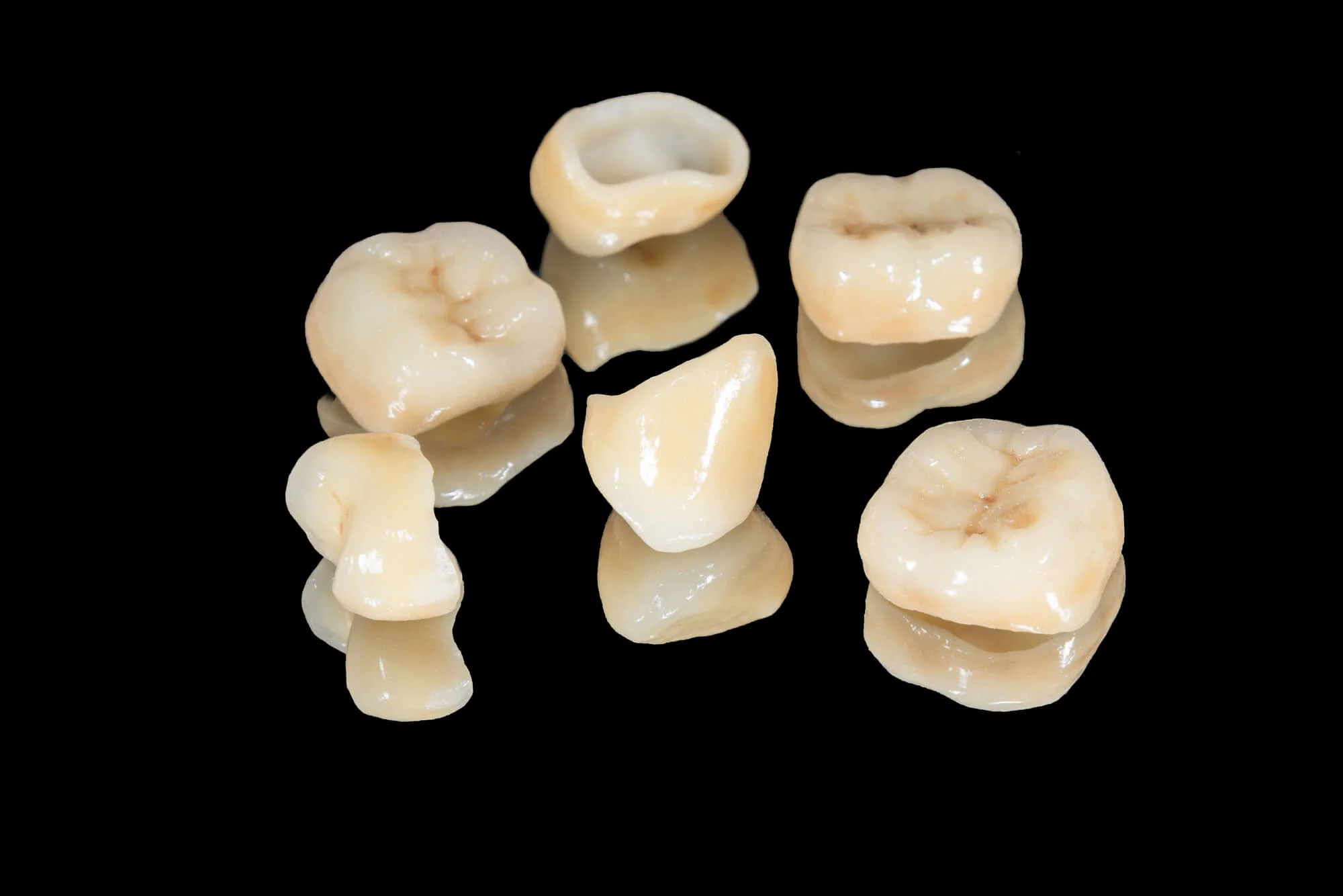 Close-up Charleston best dental crowns
