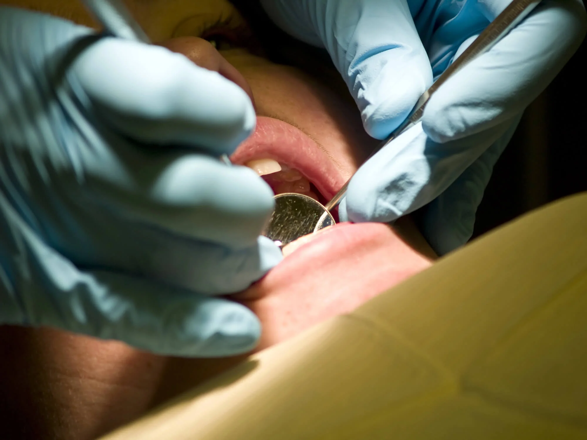 Emergency dentist in Goose Creek performing a dental exam