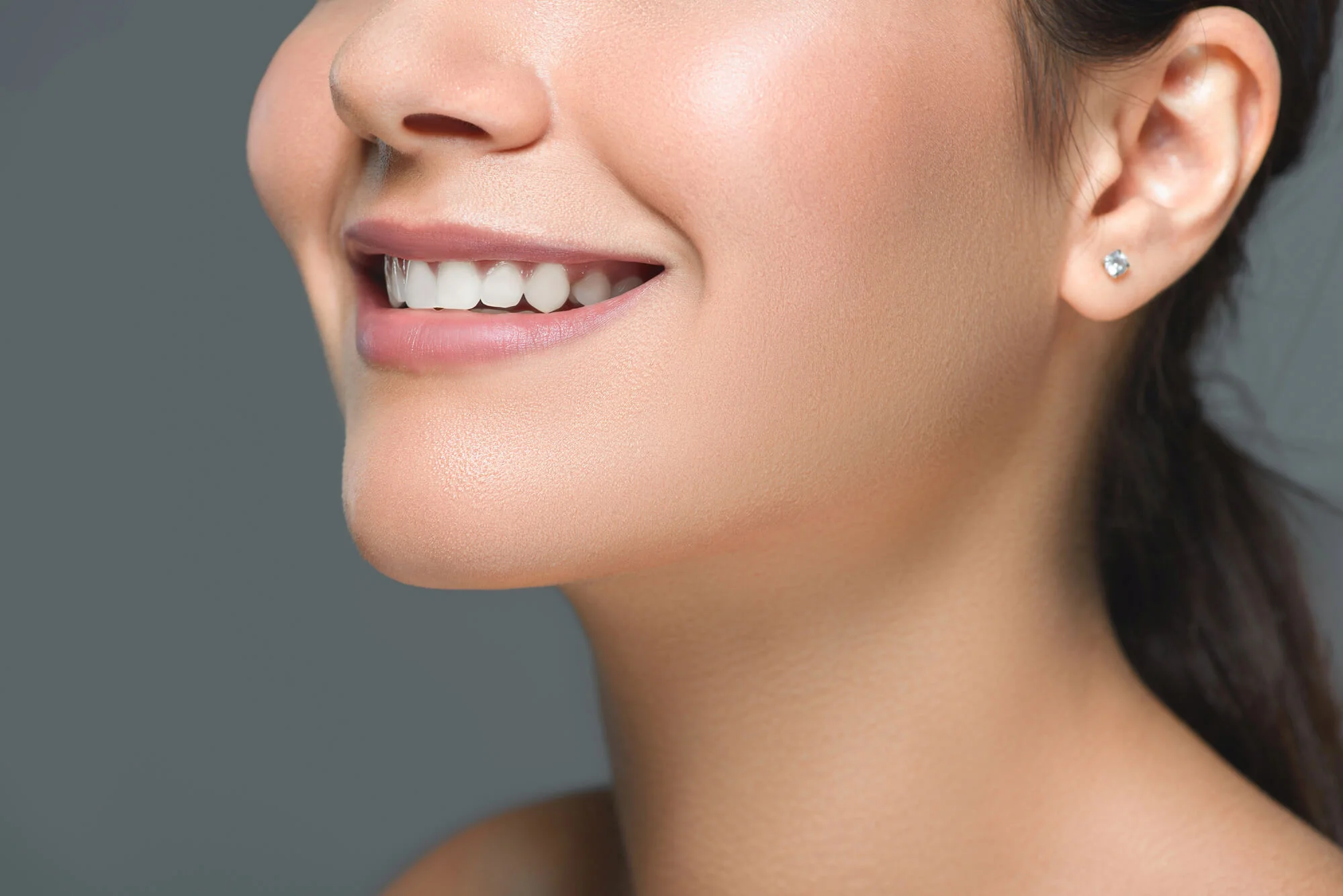 Bright smile after teeth whitening in Charleston, SC