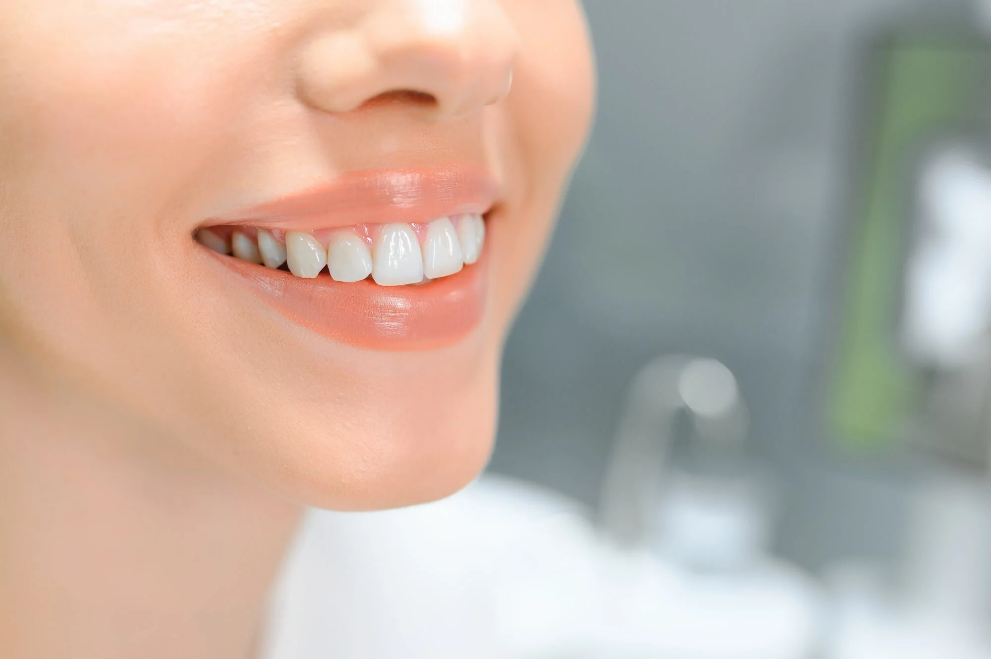 Healthy smile after teeth whitening in Charleston, SC